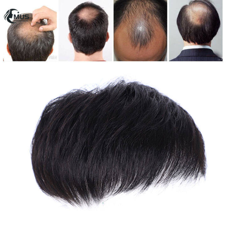 สั้นสำหรับผู้ชาย-mus-วิกผมวิกผมปิดหัวล้านเปลี่ยนระบบ-hairpiece-สำหรับทุกวัน