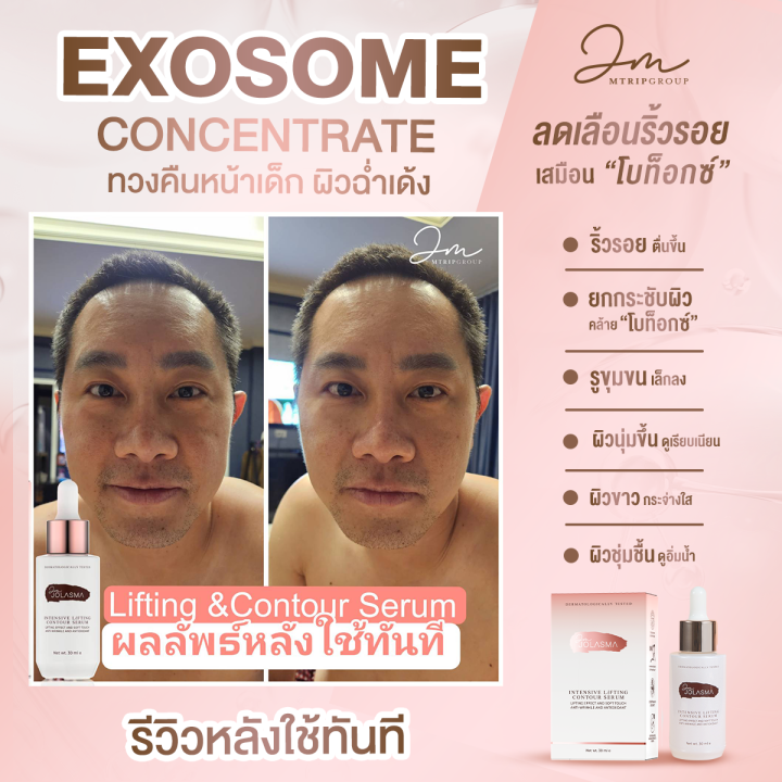 jolasma-contour-serum-โจลาสม่าเซรั่มสเต็มเซลล์แบบทา-หน้าเด็ก-ย้อน-วัย-ของแท้จากบริษัท