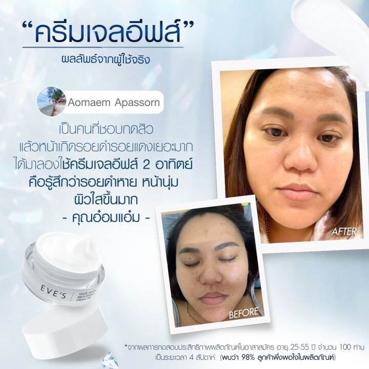 eves-ครีมเจลอีฟส์-ครีมบำรุงผิวหน้า-มอยเจอร์ไรเซอร์บำรุงผิวหน้า-white-reveal-brightening-cream-gel-คนท้องใช้ได้-5-กระปุก