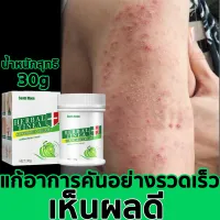 สะเก็ดเงิน กลาก ครีมลดอาการคัน ทาแก้คัน ผิวหนัง ครีมทาแก้เชื้อรา ทากากเกลื้อน สารสกัดจากพืชใช้ได้ทั้งตัว สารสกัดจากพืชใช้ได้ทั้งต