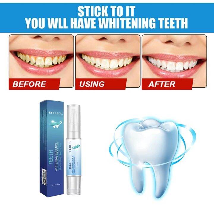 Eelhoe 4ml Teeth Whitening Kit Clean Essence 3d Pen Gel Whitener Bleach