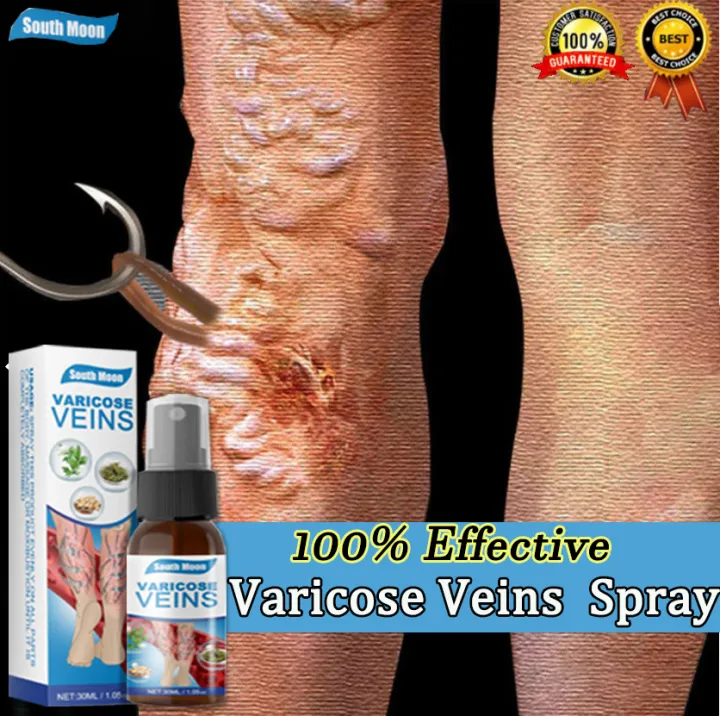 [3 Days Delivery] Varicose Veins Remover Effective Original Varicose ...