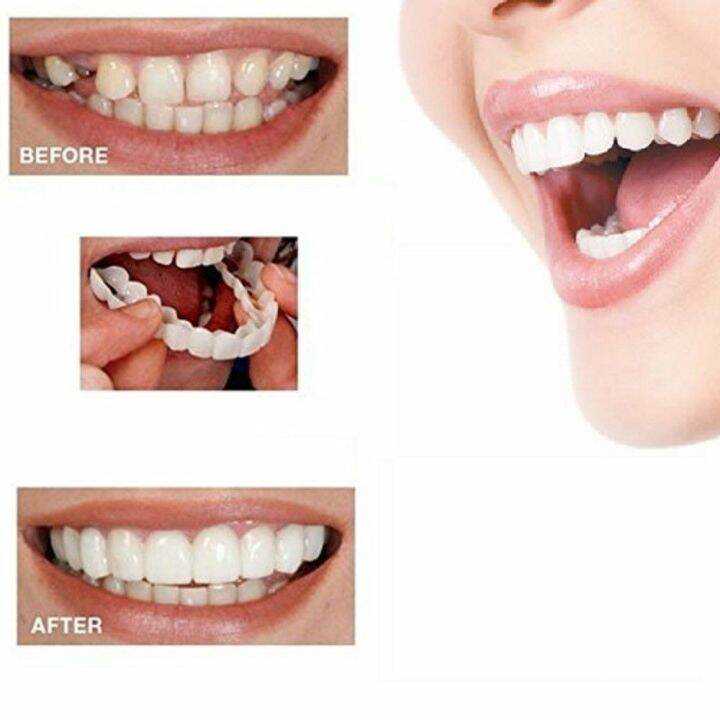 Snap on smile package dentures instant snap on smile tooth veneers ...