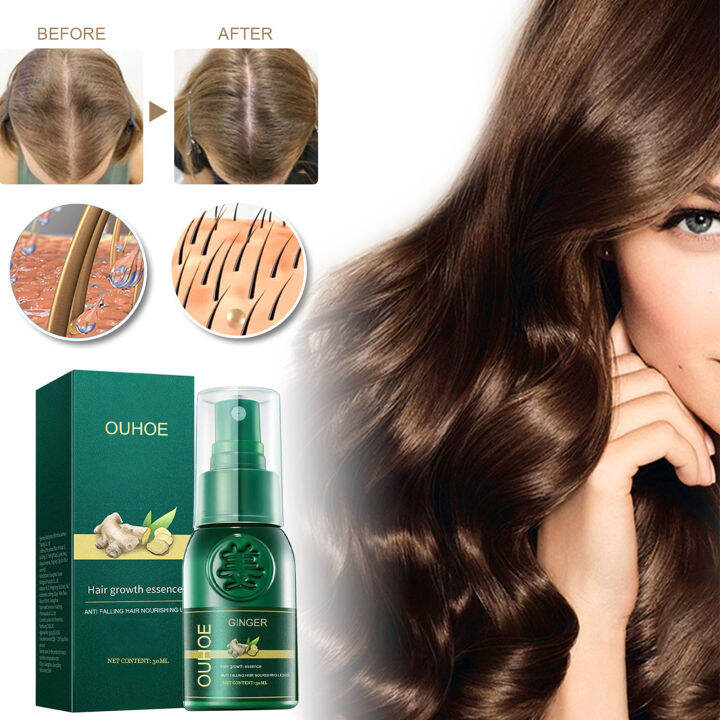 30ml Hair Growth Spray Nonirritating Natural Delicate Texture Easy to