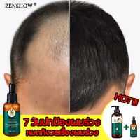 มีสินค้าพร้อมจัดส่ง ZENSHOW น้ำยาปลูกผม เซรั่มปลูกผม เซรั่มเร่งผมยาว น้ำยาเร่งผมยาว 30ml สารสกัดจากธรรมชาติ สำหรับผมบาง แก้ผมร่วง หมดกังวลเรื่องผมร่วง ยาปลูกผมของแท้ ,ป้องกันผมร่วง น้ำมันปลูกผม บำรุงผม Hair Growth Essence