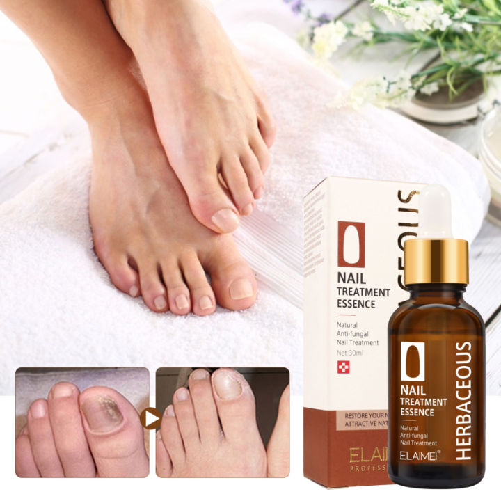 Elaimei Nail Repair Serum Fungal Nail Treatment Essence Removal Onychomycosis Paronychia Anti