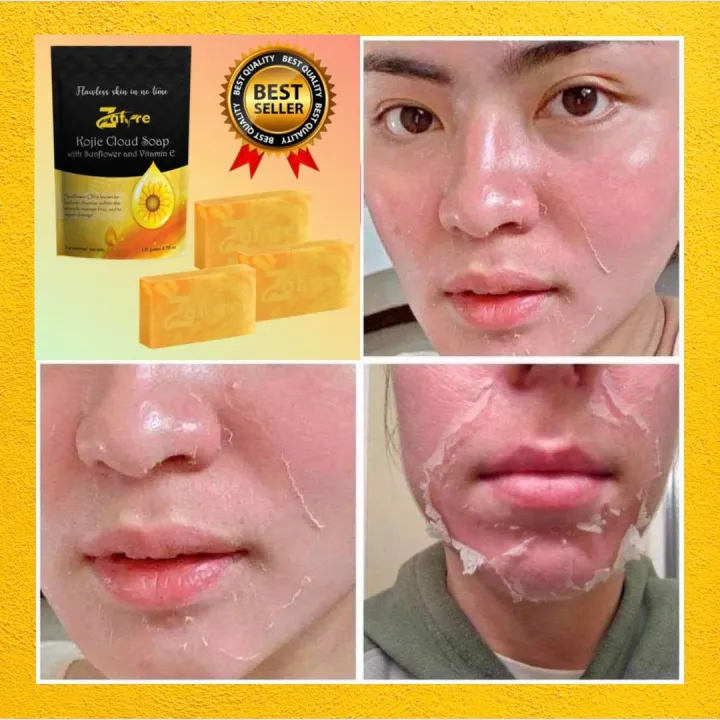 BUY1 TAKE 1 Kojic korean premium cloud soapwith sunflower oil & vitamin