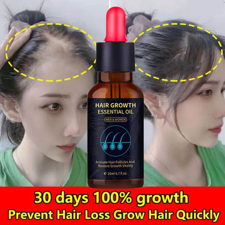 YANJIAYI Minoxidil 5% Hair Growth Essential Oil Ginger Hair Nutrient ...