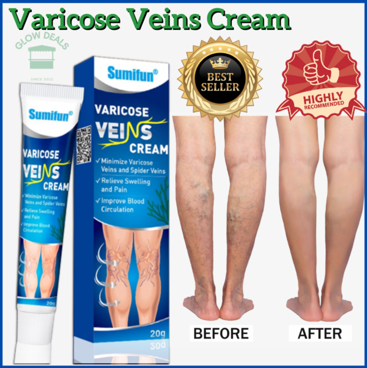 100% ORIGINAL Sumifun Varicose Veins Complete Remover Treatment Remedy ...