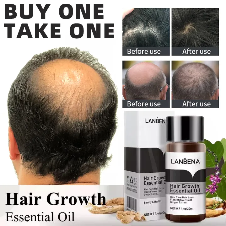 buy one take one hair grower for men women original original effective hair growth for men buy one take one hair grower for men women original original effective hair growth for men