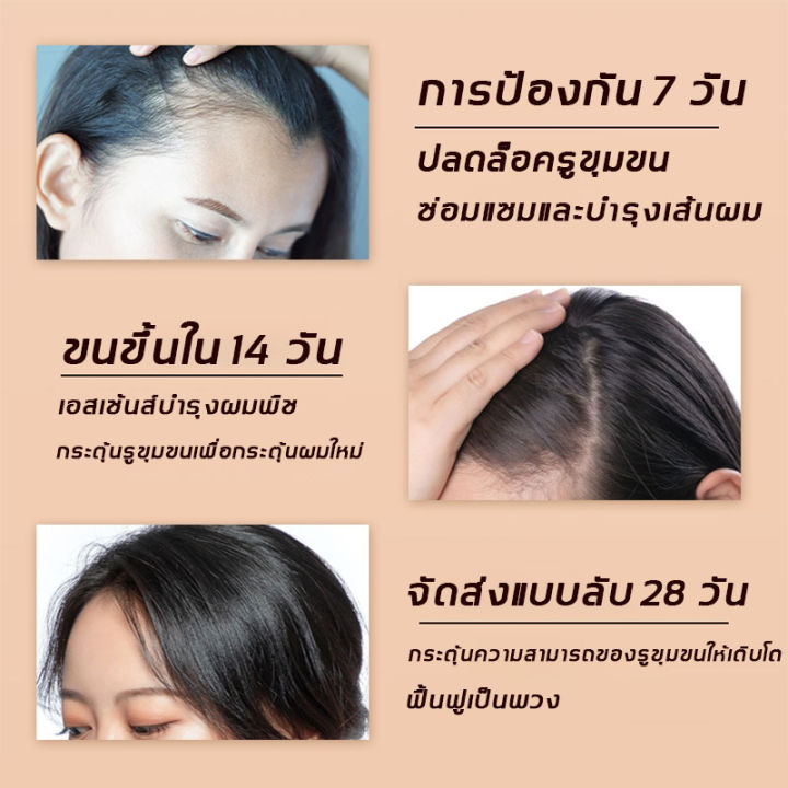 ของแท้-100-zenshow-แชมพูเร่งผมยาว-แชมพูแก้ผมร่วง-แชมพูขิงเพียว-แชมพูลดผมร่วง-ยาสระผมแก้ร่วง-แชมพูขิงของแท้-hair-loss-shampoo-ยาสระผมเร่งยาว-สูตรน้ำขิง-ปลูกผมอย่างอ่อนโยน-บำรุงรากผม-ปลูกผม-เร่งผมเกิดให