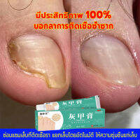 เห็นผลใน 7 วัน Xianhuaitang เซรั่มบำรุงเล็บ 20g เชื้อราเล็บมือ แก้เชื้อราที่เล็บ บำรุงเล็บ ลากับเล็บเสีย ไม่ทำร้ายเล็บดี ห่างกับปัญหาเล็บ ซ่อมแซมเล็บ