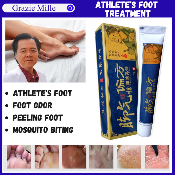 Athletes foot cure cream Suitable for itching foot, foot blisters