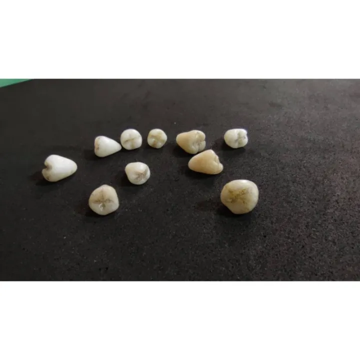 👉ขาวเหลือง สกปรก👈 👉5 ซี่👈 ฟันปลอม แต่งเอฟเฟคพิเศษ และงาน DIY /แต่งแผลปลอม แต่งหน้าผี Halloween