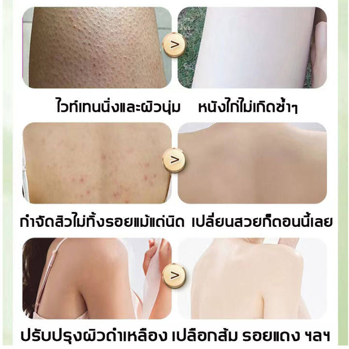 โลชั่นผิวขาว-โลชั่นบำรุงผิว-ครีมทาผิวขาว-ครีมอาบน้ำขาว-ครีมเร่งผิวขาว-โลชั่นเร่งขาว-ครีมผิวขาวเร็ว-โลชันทาผิวขาว-โลชั่นกันแดด-ไวท์เทนนิ่ง-กันแดดผิวกาย-โรชั่นเร่งขาว-ครีมรักแร้ขาว-ครีมบำรุงผิว-บำรุงผิว