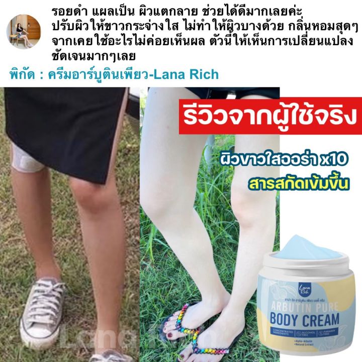 ลาน่า-ริช-อาร์บูตินเพียว-บอดี้-ครีม-ครีมสูตรแรงเข้มข้น-เห็นผลไว-สูตรเร่งขาว-ลดรอยเเตกลาย-ผิวออร่ากระจ่างใส