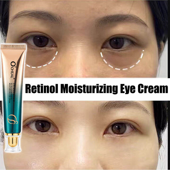 Retinol Elastic Eye Cream Fade Dark Circles Eye Bags Fine Lines Firming
