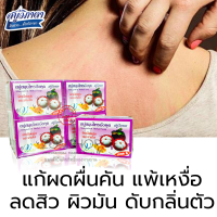 [70g.x12ก้อน] Vipada สบู่วิภาดา มังคุด&amp;น้ำผึ้ง ผิวเนียนนุ่ม แก้ผดตื่นคัน  แพ้เหงื่อ สิวอักเสบ ผิวมัน ดับกลิ่นตัว