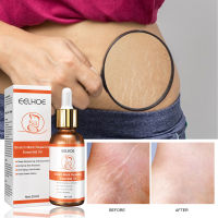 EELHOE pattern repair removal essential oil pregnant women lifting relaxation line firming skin care solution remove pregnancy