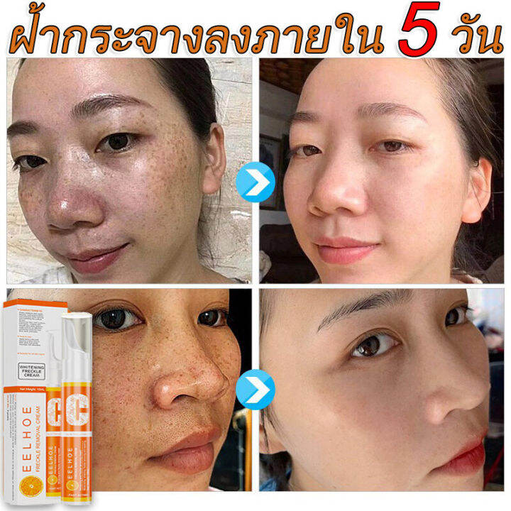 vit-c-เซรั่มหน้าใส-เซรั่มลดฝ้ากระ-ครีมทาฝ้ากระ-ครีมทาหน้าใส-ครีมรักษาฝ้า-ฝ้ากระจางลง-ให้ความชุ่มชื้น-ไวท์เทนนิ่ง-freckle-serum