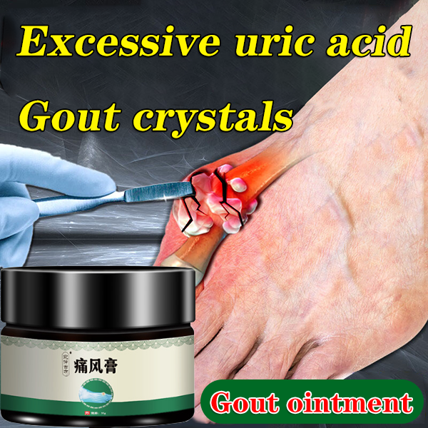 Gout cream Relieve joint pain Gout uric acid treatment Ointment 35g