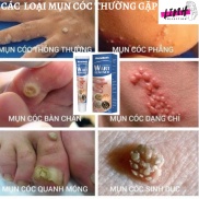 Loại bỏ mụn ruồi trâu,mụn thịt,mụn cóc,mụn cơm cứng đầu nhanh chóng