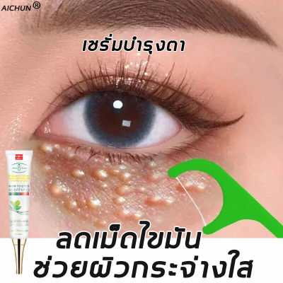 AICHUN ครีมบำรุงตา30ml อายครีม ปรับปรุงอนุภาคไขมันและฟื้นฟูผิวรอบดวงตา ครีมทาถุงใต้ตา ครีมบำรุงรอบตา ดูแลรอบดวงตา บำรุงรอบดวงตา ครีมทารอบดวงตา อายครีมบำรุงตา ครีมถุงใต้ตา ครีมทาใต้ตา ครีมบำรุงรอบดวงตา อายเจล ครีมไต้ตา บำรุงสายตา เซรั่มอายครีม รอยตีนกา