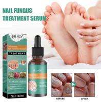 Linwei EELHOE paronychia repair liquid nail care liquid foot care essence