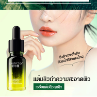 VK SHOP น้ำมันเซรั่มบำรุงผิวหน้าลดความมันและซ่อมแซมรูขุมขน