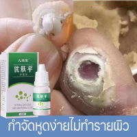 wart removal liquid เอสเซ้นลอกหูด 10ml ยาแต้มหูด ลอกหูดตาปลา ปลอดภัยไม่เจ็บตัว ขจัดติ่งเนื้อ เอสเซ้นลอกหูด ไม่ทิ้งร่องรอยป ครีมกําจัดไฝหูดติ่งเนื้อ