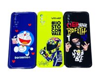 เคส Tpu ขอบสีนิ่ม รุ่นมือถือ Wiko U20  ไม่ทำให้เครื่องเป็นรอย เก็บเงินปลายทางได้ เคสตรงรุ่น Wiko U20 ครับ งานสีสวย บริการเก็บเงินปลายทางได้ครับ