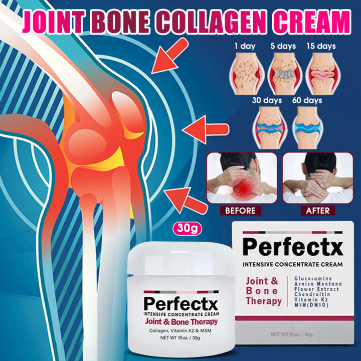 Perfectx Intensive Joint and Bone Therapy Cream Gout Cream Perfectx ...