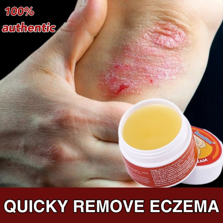 Eczema Treatment cream original eczema treatment cream ointments for