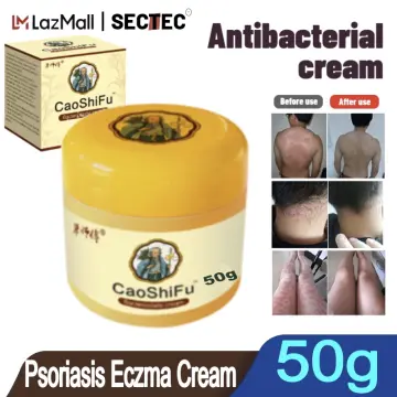 Haemin cream for eczema