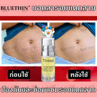 ครีมลบรอยแตกลาย BLUETHIN 10มล ครีมรอยแตก ครีมทาท้องลาย ครีมลดรอยแตกลาย ลดผิวแตกลาย แก้แตกลาย ครีมทาผิวเด็ก พรีเชียส สกิน บอดี้ครีม ครีมแก้ท้องลาย ครีมลดลอยแตกลาย ครีมทาผิว ครีมลดรอยแตก ครีมทาแตกลาย ครีมลดลอยเเตก ครีมทากันเเตกลาย ครีมทาผิวแตกลาย