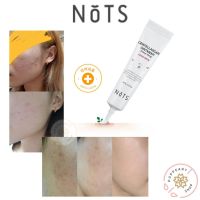 (แท้/พร้อมส่ง) NOTS CENTELLA SCAR OINTMENT [YLANG-YLANG] 15G ครีมรักษารอยสิว #รักษาสิว  #โทนเนอร์  #สิว  #ป้องกันสิว  #ลดสิว  #ลดรอยดำ