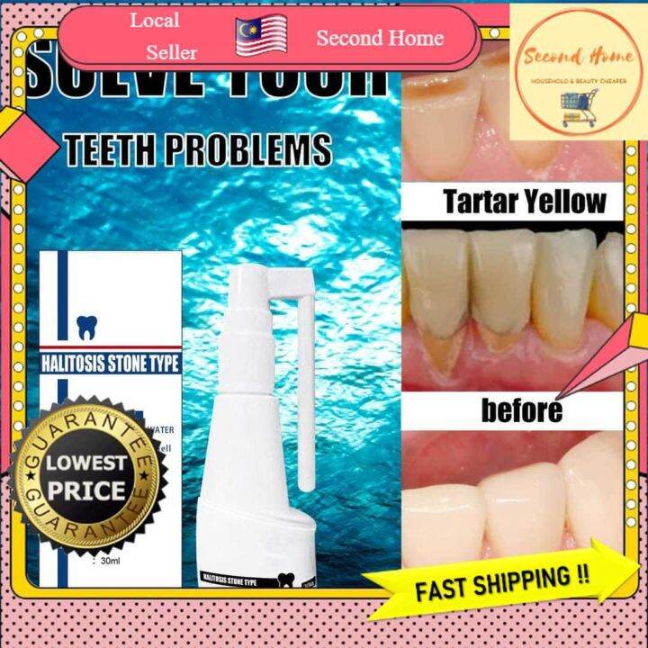🇲🇾【BUY1 FREE1】🌟Ready Stock🌟 Halitosis Stone Type Dental Cleaning Water