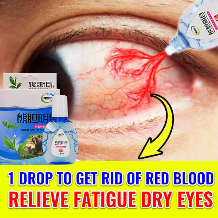 【restore You Vision】original Eyedrops Organic Mineral Drops For Used 