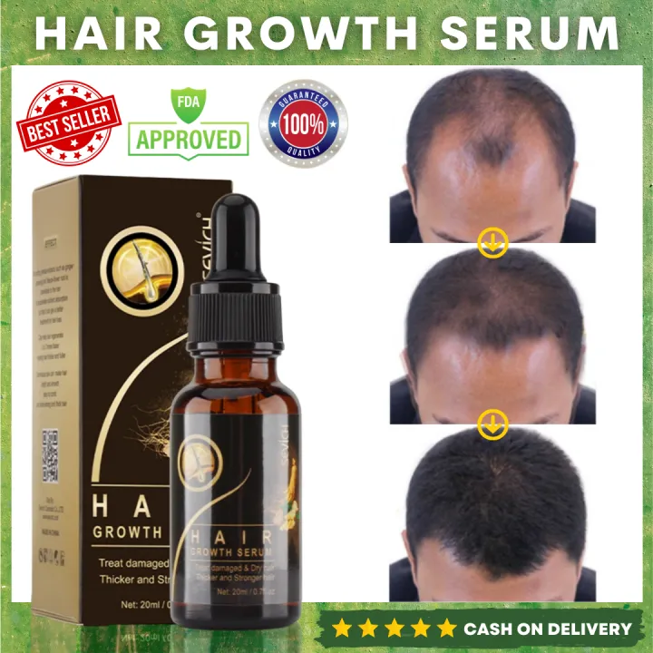 🔥Best Seller Original Effective Hair Growth Serum🔥Hair Loss Anti Thinning  Hair Long Hair