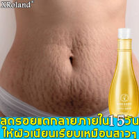 XRoland ครีมลดรอยแตก ขาแตกลาย 150g ลดรอยแตกลาย เพิ่มความชุ่มชื้นให้แก่ผิว กระชับผิวให้เรียบเนียน (ครีมทาแตกลาย,ครีมทารอยแตกขา,ครีมกันแตกลาย,ครีมทาท้องลาย,ครีมทารอยแตก,ครีมรอยเเตกลาย,ครีมทาหลังคลอด,ครีมแก้แตกลาย,ครีมแก้ท้องลาย ลดผิวแตกลาย,ครีมท้องลาย)