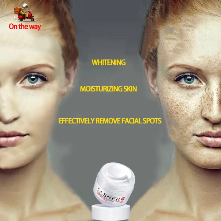 Cream For Face Removal Cream Original Whitening Freckle Acne Spot Treatment Dark Spot Remover Dark Spot