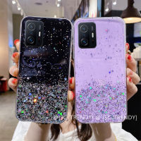 เคสโทรศัพท์ Xiaomi 11T Pro Redmi 10 Mi 11 Lite 5G NE Mi 10T Pro Phone Case เคสเลื่อมสีสันใสแวววาว Starry Sky นุ่มฝาหลัง