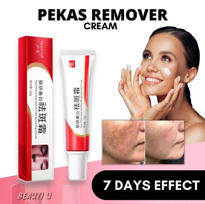 Pekas Remover Effective Freckle Remover Original Melasma Cream Spot ...