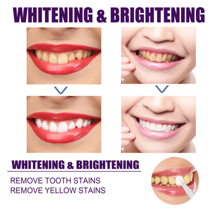 Hismile Professional Dental Whitening Purple Mousse Toothpaste V34 ...