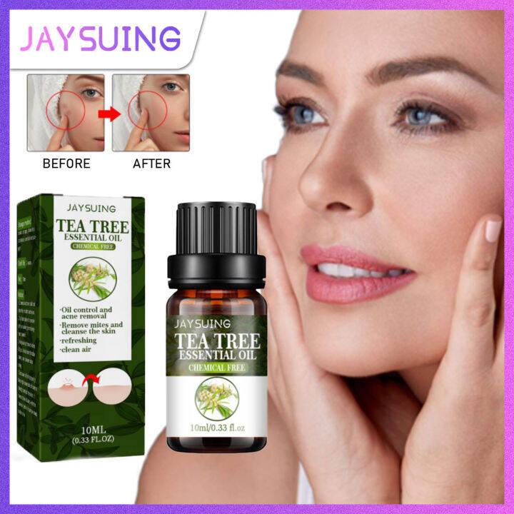 Jaysuing Tea Tree Essential Oil for Acne Scar Removal Fight Acne