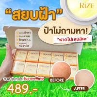 #ส่งฟรี Rize MELASMA ครีมสยบฝ้า