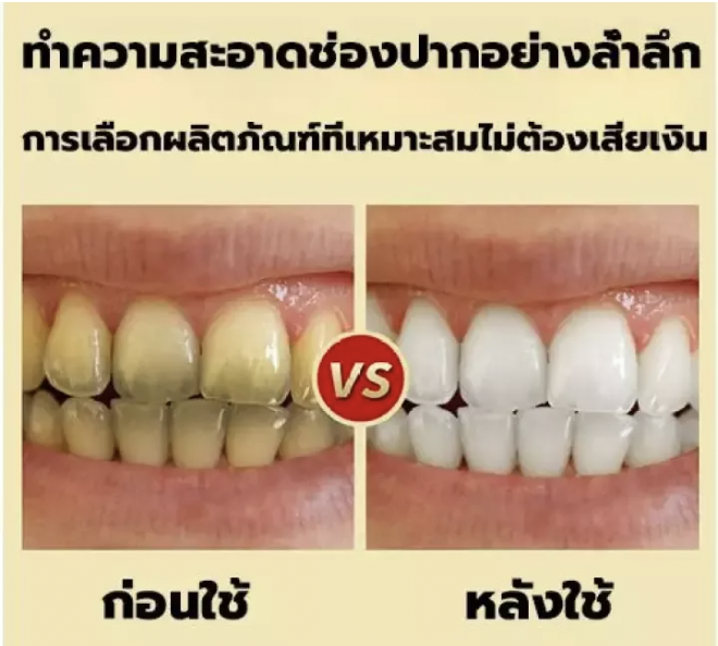 ยาสีฟัน-สูตร-ยาสีฟันเอนไซม์-ฟันขาว-ขจัดคราบหินปูน-ลดกลิ่นปาก-ดีเยี่ยม