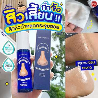 Kimhanshops One Days You P.Z. SSOC SSOC No More Blackhead