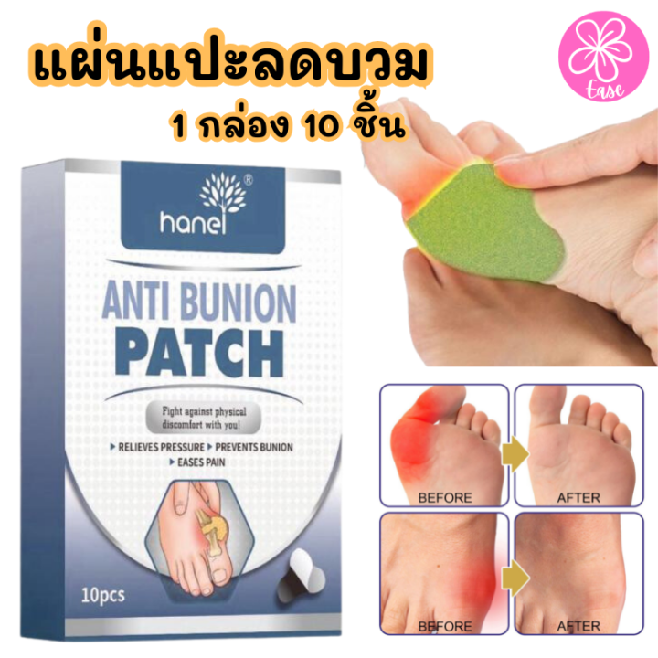 hanel-anti-bunion-patch-แผ่นแปะเท้า-แผ่นแปะเท้าลดปวด