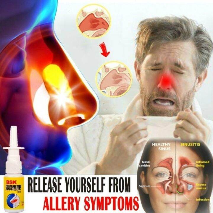 【CW】 10ML Chinese Nasal Sprays Powerful Rhinitis Cure Spray Treatment